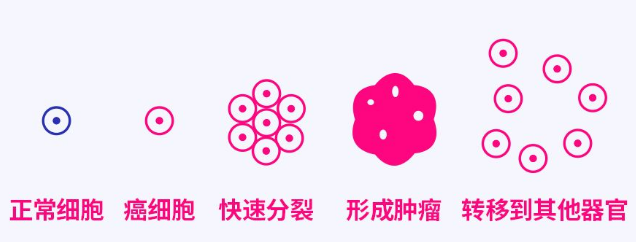 負氧離子防治癌癥 負氧離子防治癌癥