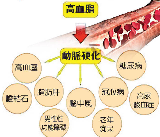 小粒徑負氧離子能夠對高血脂的防治發揮顯而易見的影響 小粒徑負氧離子能夠對高血脂的防治發揮顯而易見的影響