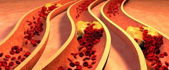 空氣負離子也開始應用于高血脂的防治,并取得很好的療效 空氣負離子也開始應用于高血脂的防治,并取得很好的療效